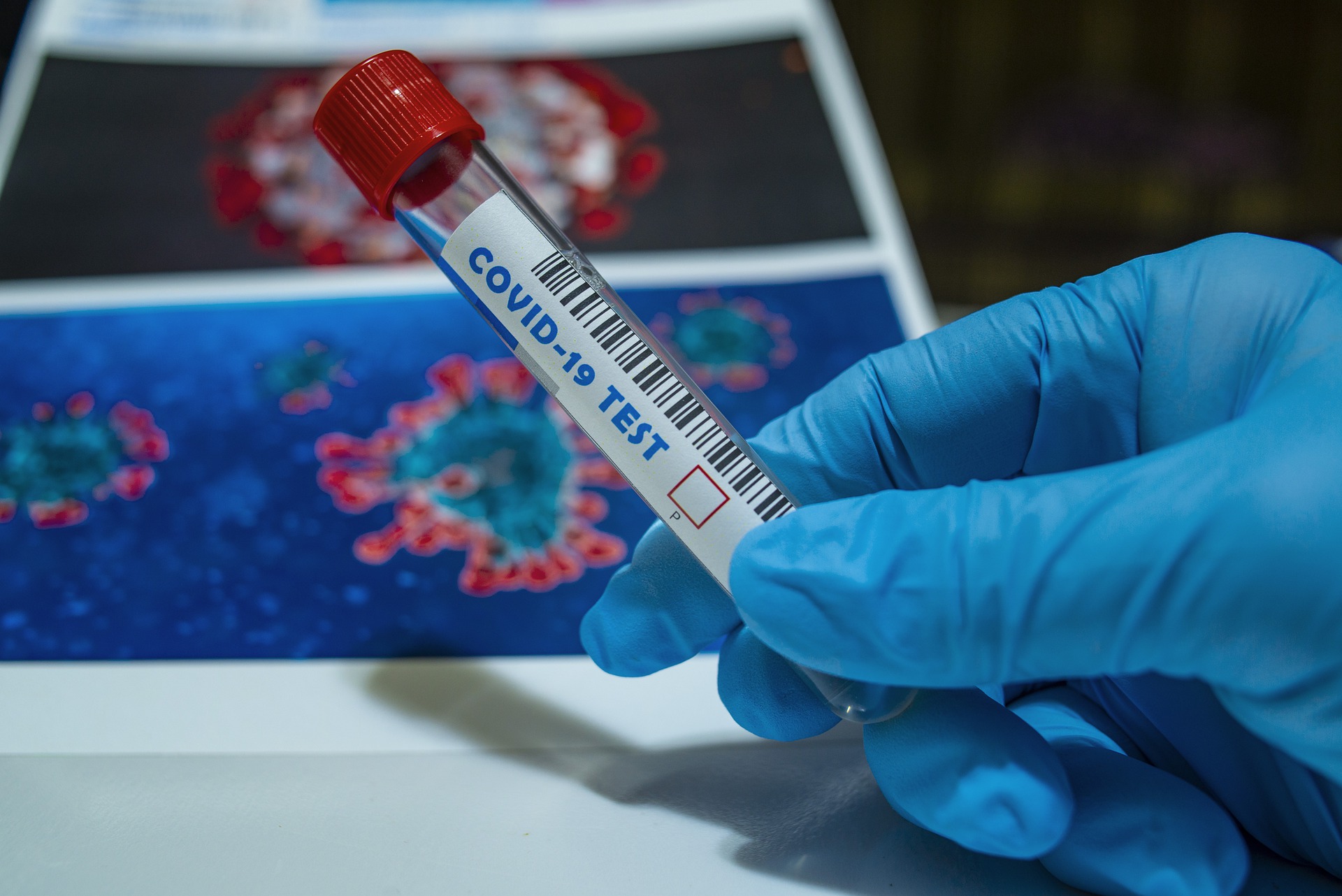 A gloved hand holds a COVID-19 test tube with a red cap, as the backdrop showcases virus images at The Baton Rouge Clinic.