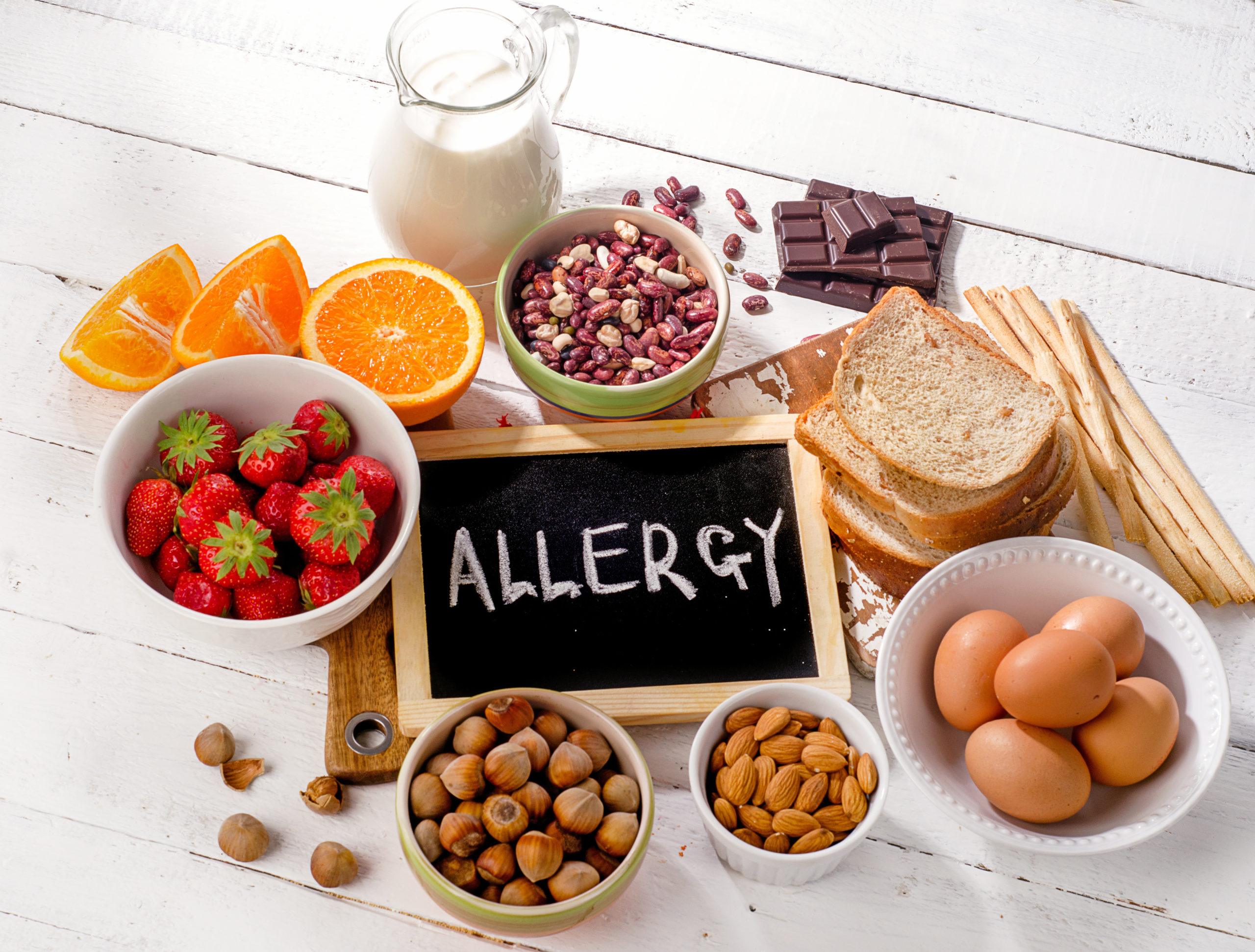 Is Your Gut Issue a Food Allergy? - Baton Rouge Clinic