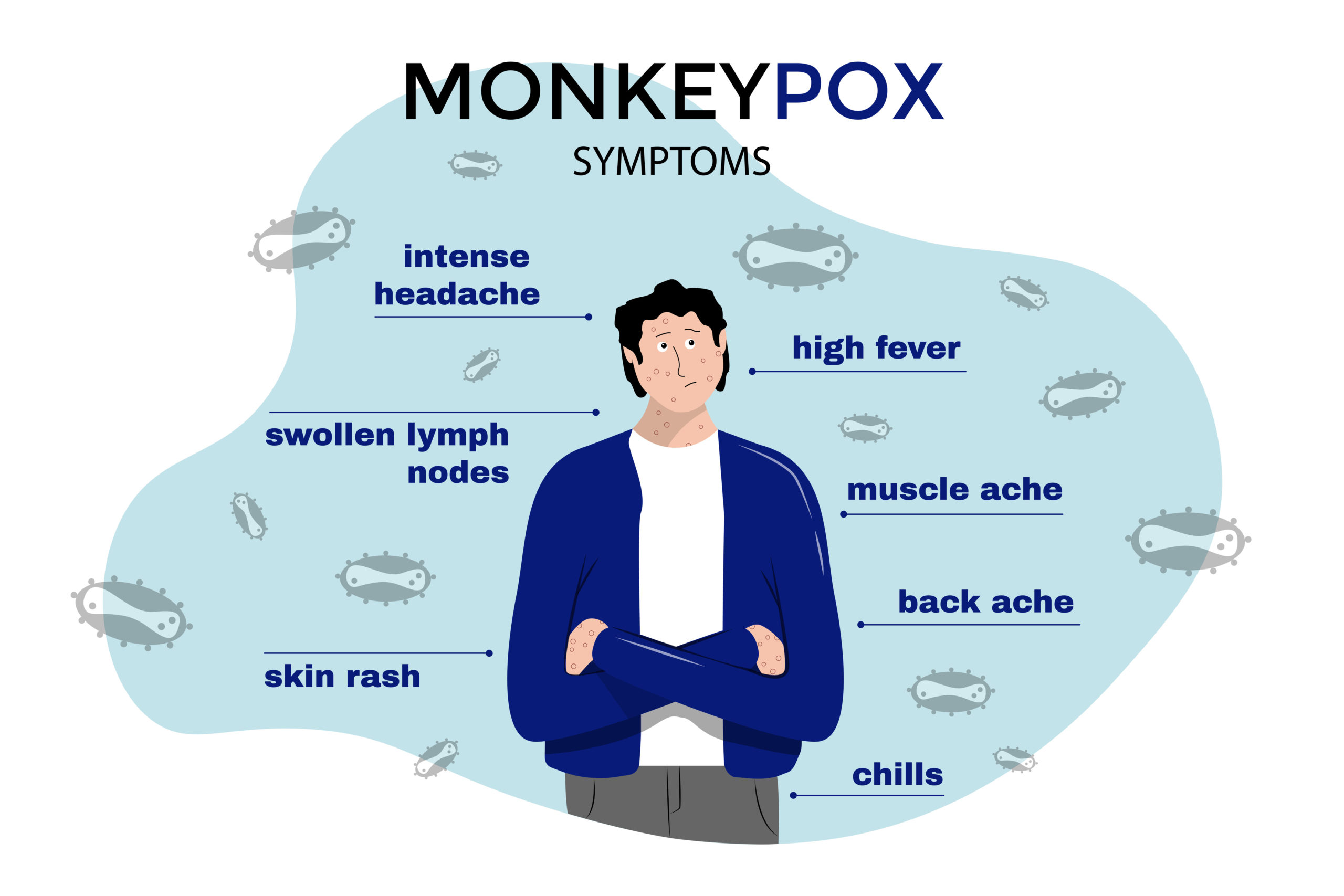 What are the Symptoms of Monkeypox?